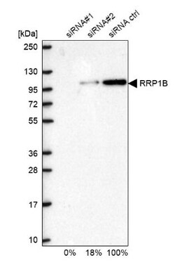 RRP1B Antibody, Novus Biologicals 0.1mL; Unlabeled:Antibodies, Polyclonal